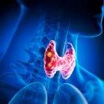 Πότε οι όζοι θυρεοειδούς είναι επικίνδυνοι